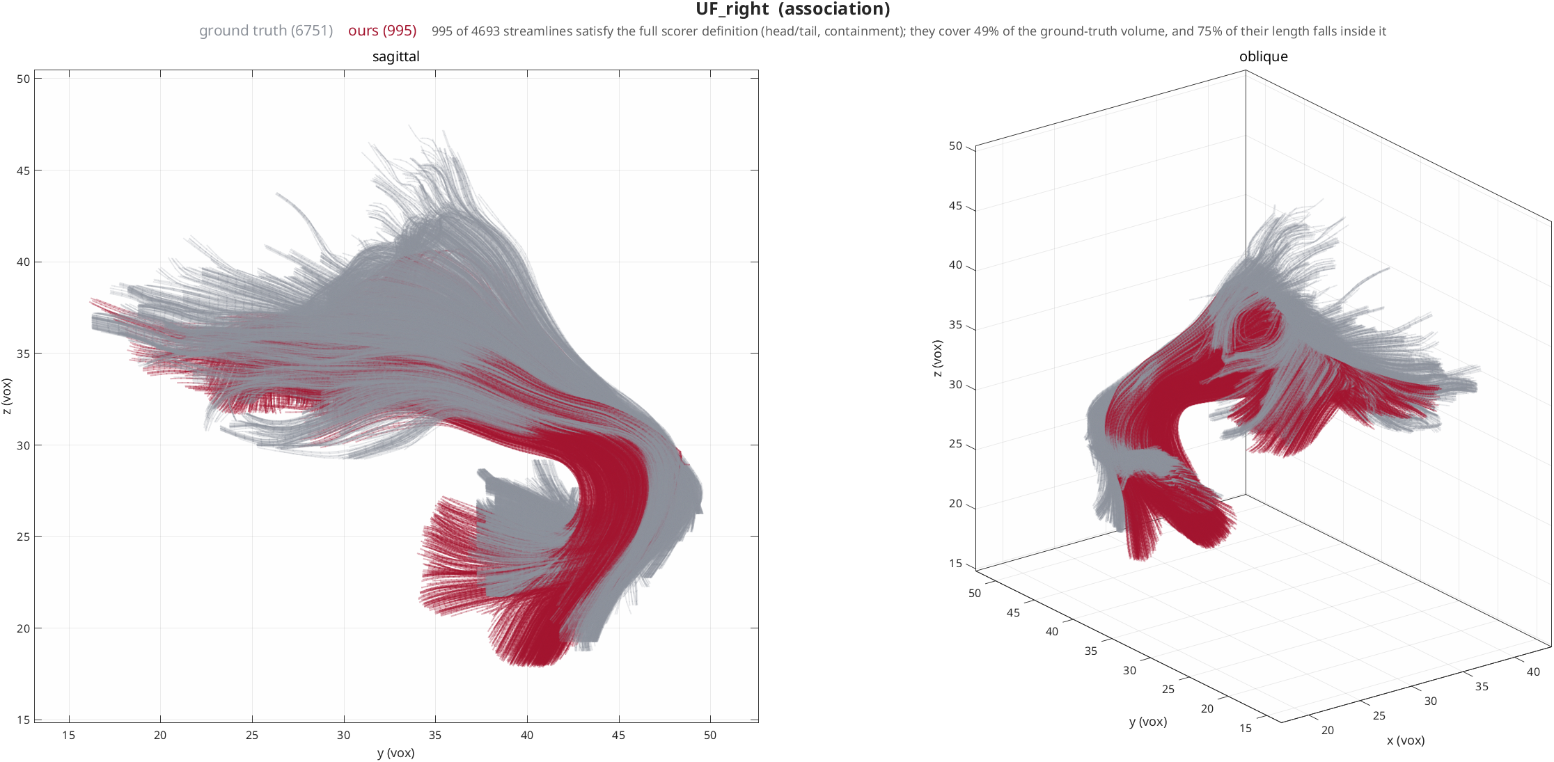 Right uncinate fasciculus: ours against the ISMRM ground truth