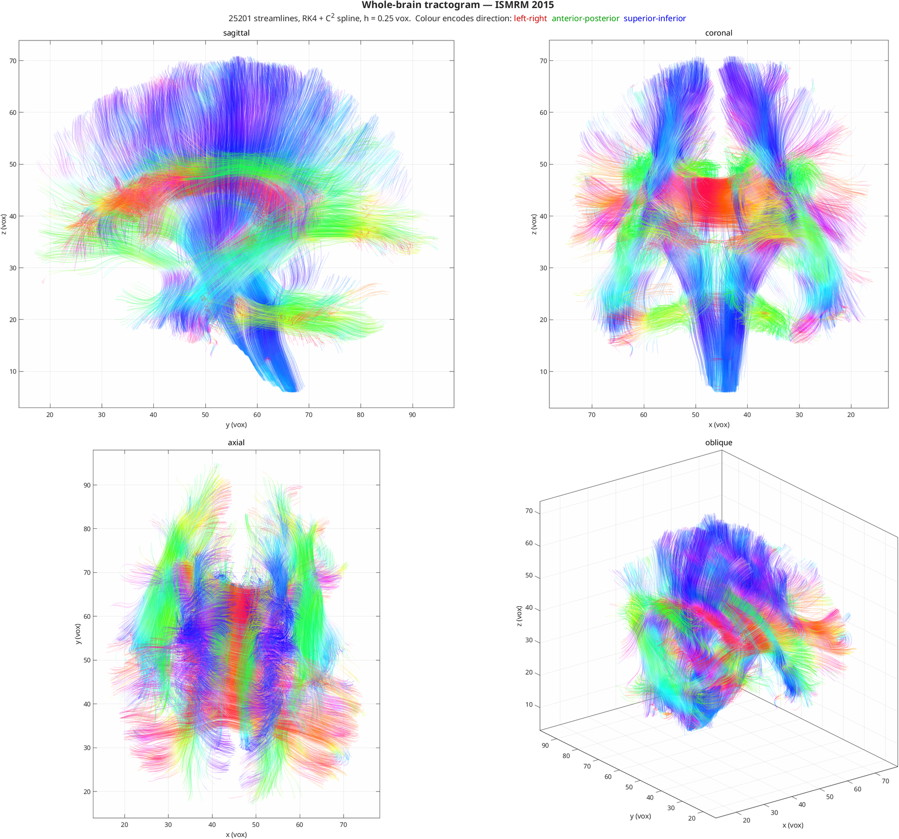Whole-brain tractogram